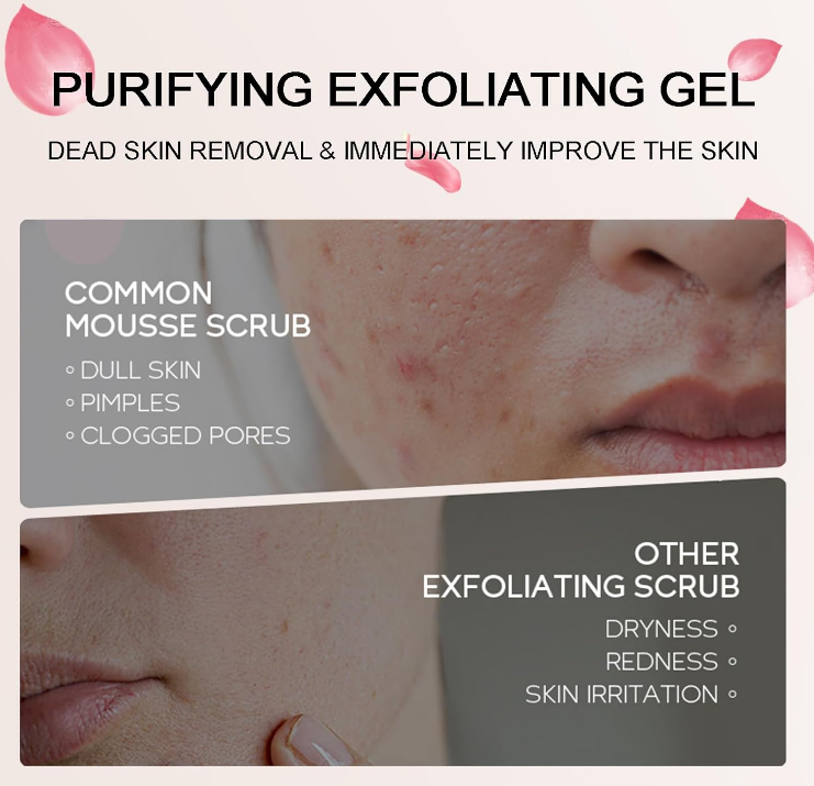 Bare Balance™ Exfoliating Gel – Reveal Smooth, Radiant Skin Naturally